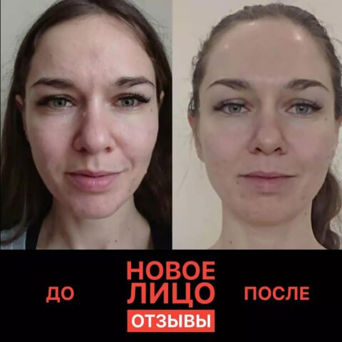 новое лицо отзывы