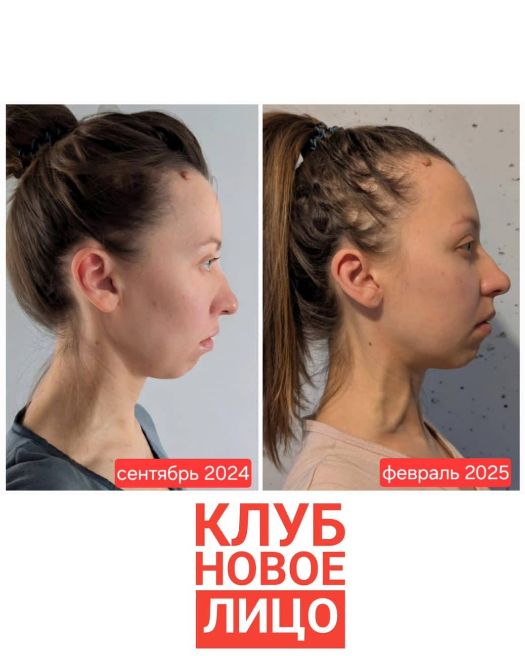 новое лицо естественное омоложение алия мусина