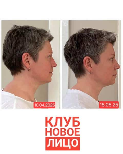 клуб новое лицо естественное омоложение алия мусина антиэйдж