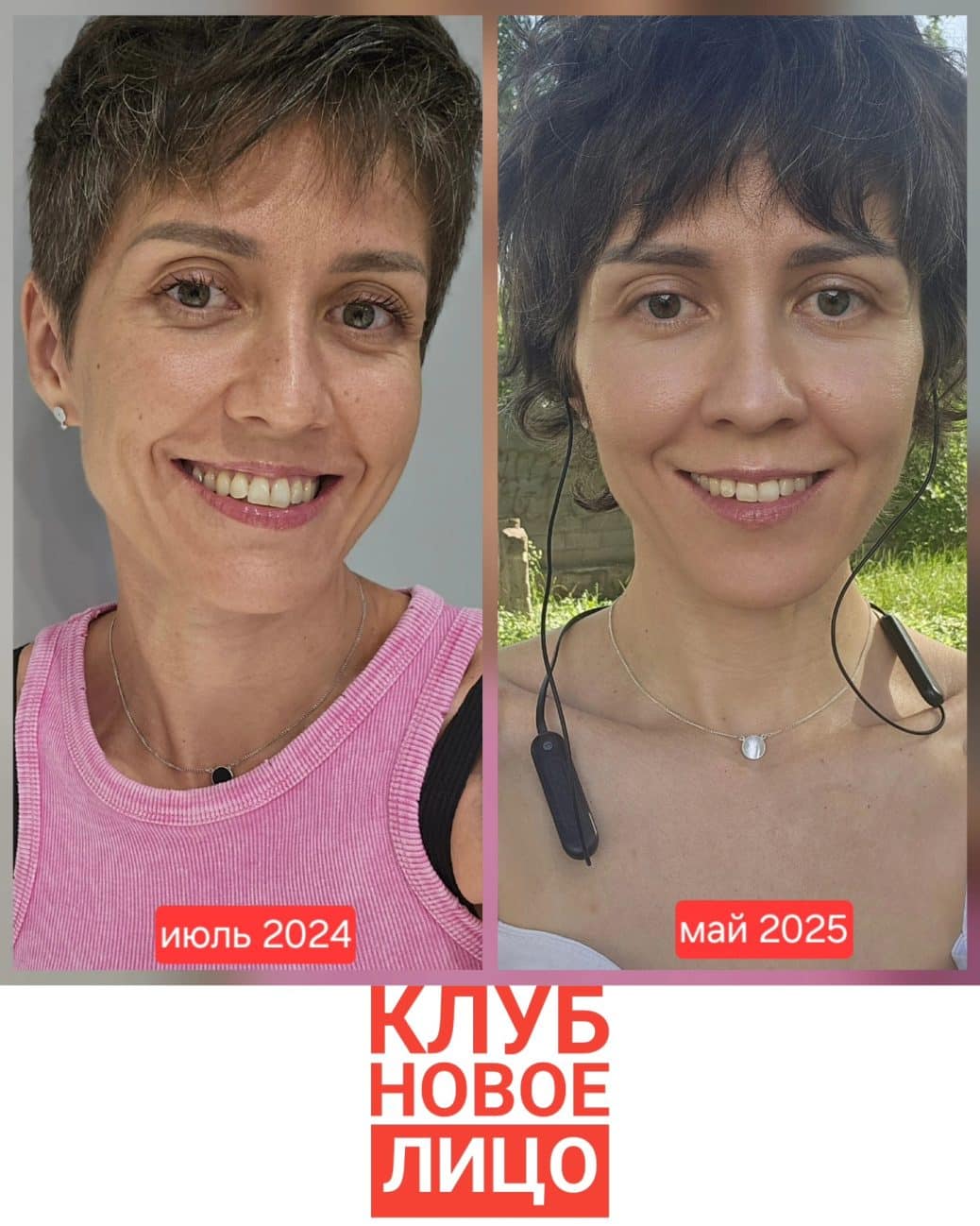 клуб новое лицо алия мусина естественное омоложение