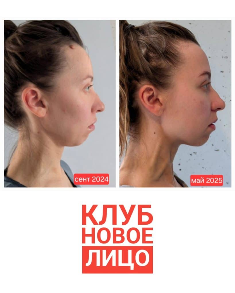 клуб новое лицо естественное омоложение алия мусина результаты