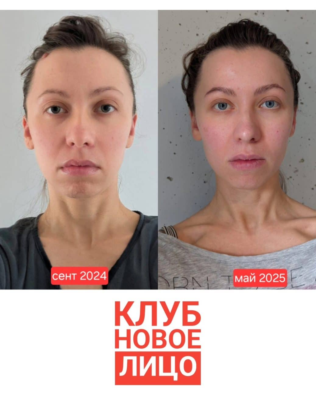 клуб новое лицо алия мусина естественное омоложение результаты