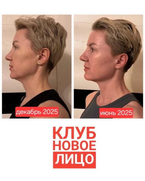 клуб новое лицо курс естественного омоложения алия мусина