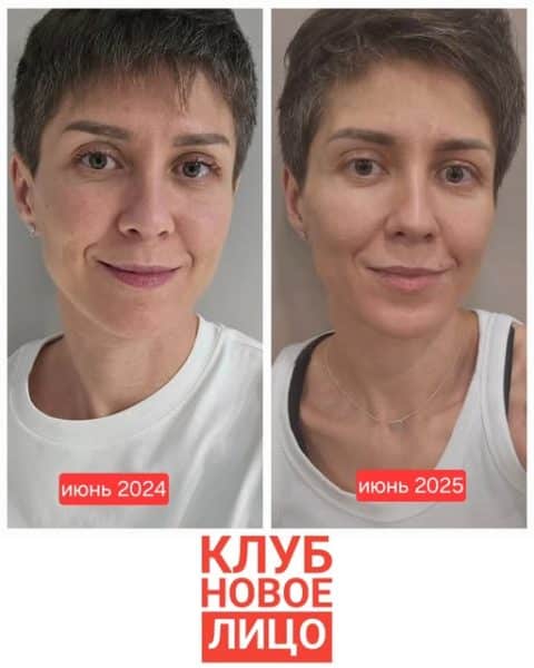 клуб новое лицо естесвенное омоложение алия мусина