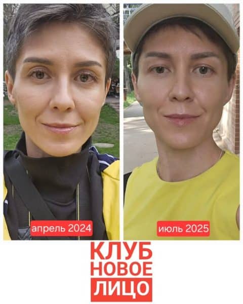 новое лицо естественное омоложение алия мусина