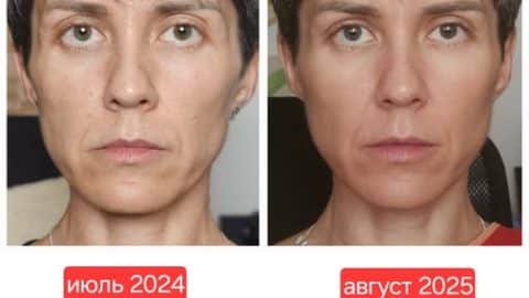 клуб естественного омоложения новое лицо