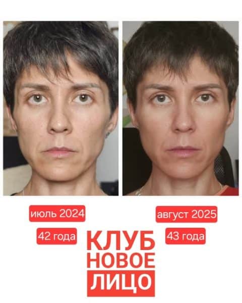 клуб естественного омоложения новое лицо