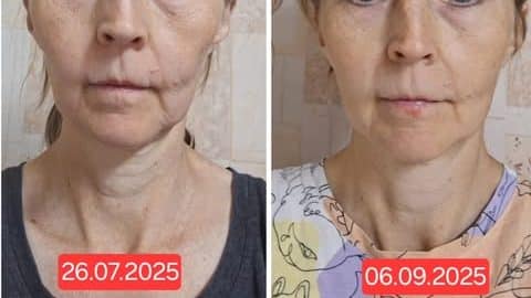 клуб новое лицо естественное омоложение алия мусина