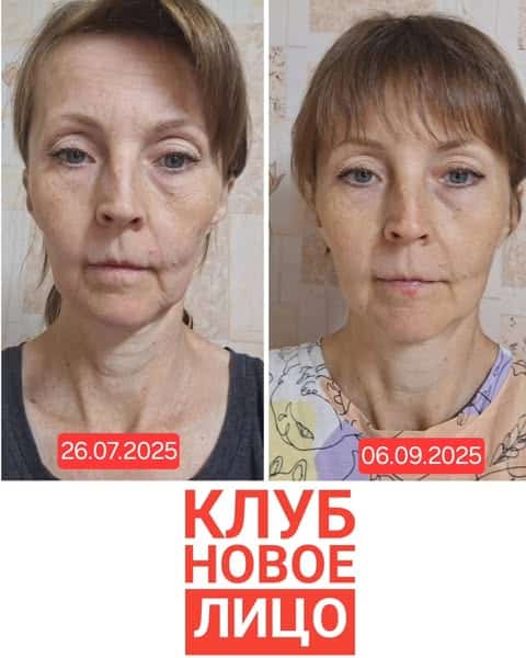 клуб новое лицо естественное омоложение алия мусина