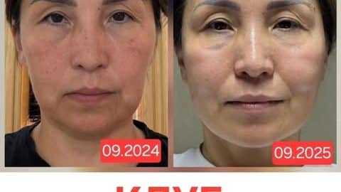 клуб новое лицо естественное омоложение