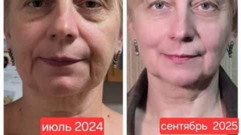 клуб новое лицо естественное омоложение алия мусина