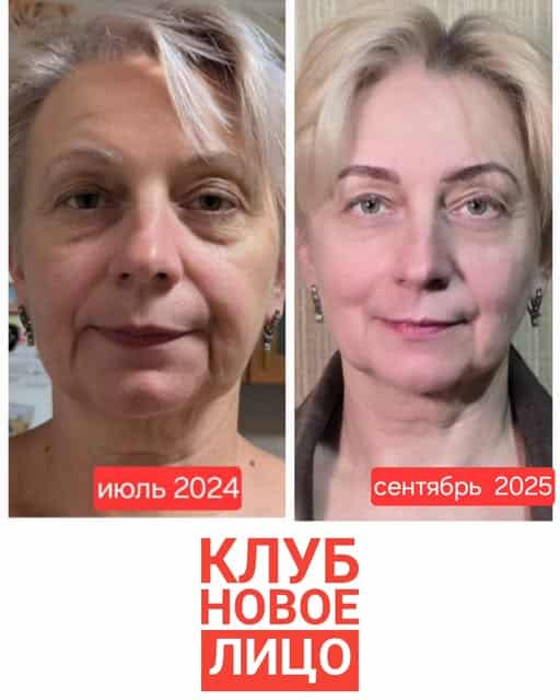 клуб новое лицо естественное омоложение алия мусина