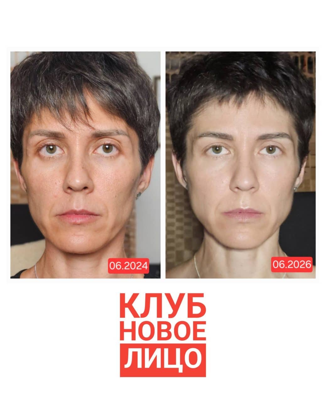 новое лицо клуб естественного омоложения алия мусина